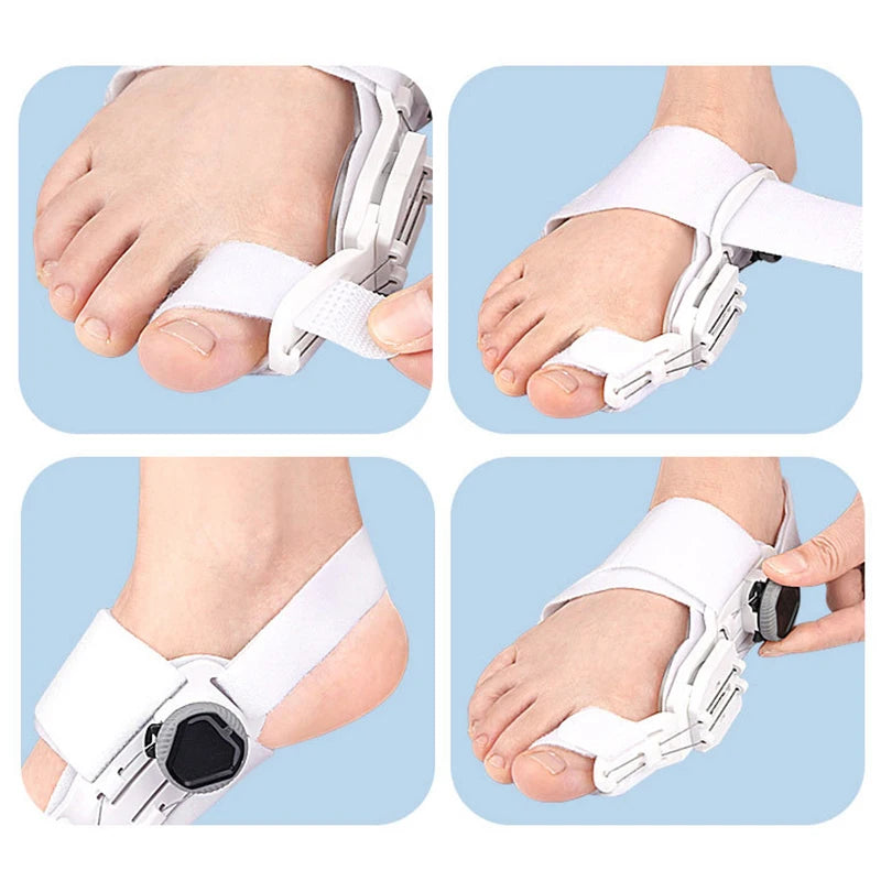 Bunion Corrector – Adjustable Toe Alignment Support for Daily Comfort - GleamPrism
