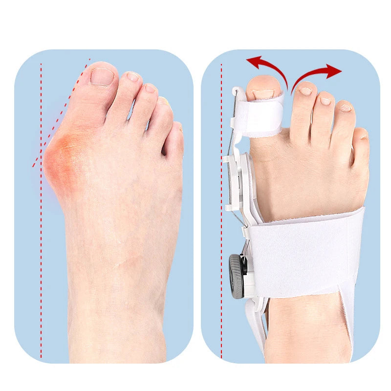 Bunion Corrector Unisex Foot Hallux Valgus Braces