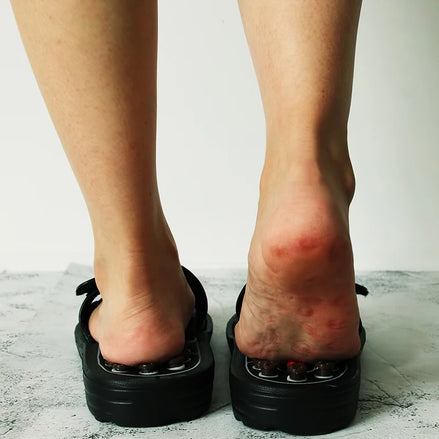 Acupressure Massage Slippers